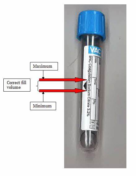 Aspirin Platelet Function - Beebe Healthcare Laboratory Services